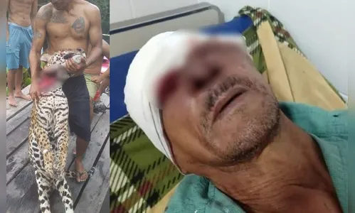 Idoso é internado em estado grave após ser atacado por onça