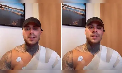 Leo Stronda mostra queimaduras após acidente doméstico