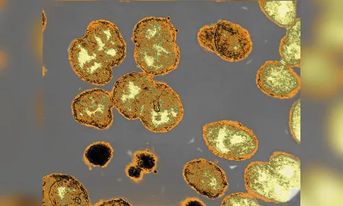 Menina contrai gonorreia após mergulhar em piscina termal