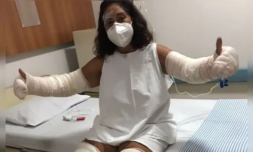 Mulher sofre queimaduras após frasco de desodorante explodir