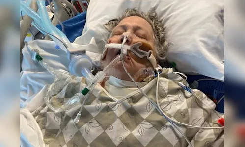 Paciente acorda no dia em que teria aparelhos desligados