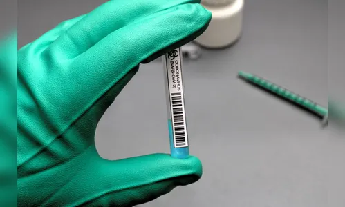 Paraná registra 2.239 novos casos e 84 óbitos pela Covid-19