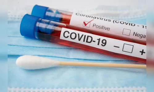 Sesa confirma 1.723 novos casos e 55 óbitos por Covid-19