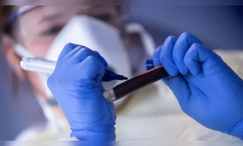 13 novos casos de Covid-19 confirmados em Ivaiporã