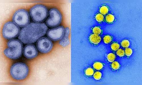 Adolescente é infectado por Covid e Influenza ao mesmo tempo