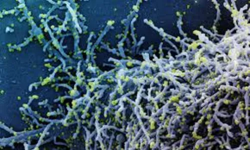 Brasil fechará fronteiras aéreas para seis países da África