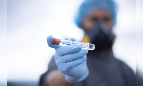 Covid-19: Arapongas não registra casos e óbitos neste sábado