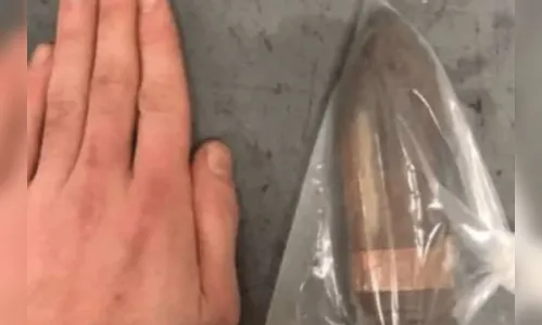 Homem com bala de canhão no ânus vai parar no hospital