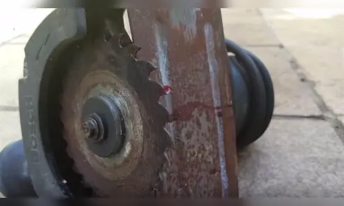 Homem corta dedos em acidente doméstico em Apucarana