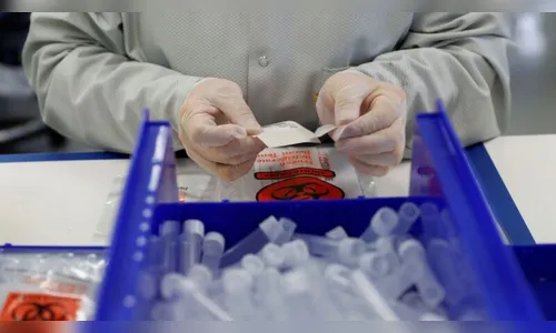 Jardim Alegre registra mais 18 casos de Covid-19