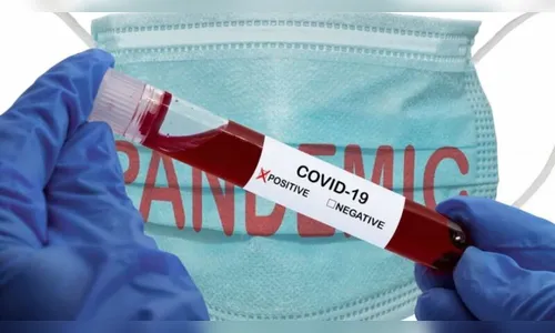 Saúde de Ivaiporã registra mais 62 casos de coronavírus