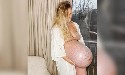 Influencer chama atenção na web com barriga de trigêmeos