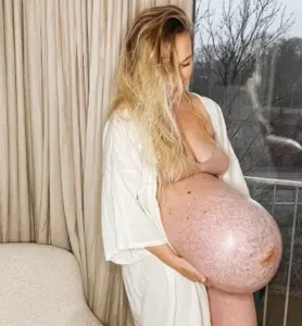 Influencer chama atenção na web com barriga de trigêmeos