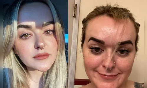 Mulher dorme e tem franja 'mastigada' por porquinho-da-índia