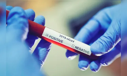 Mulher se exalta exigindo teste da covid; PM é acionada