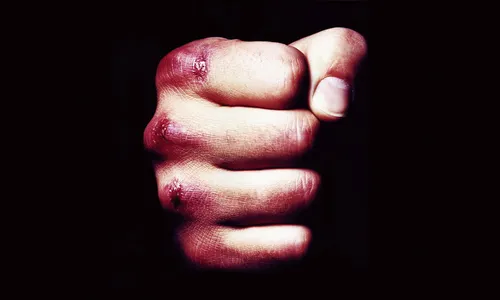 Mulher usa faca para se defender do marido em Arapongas