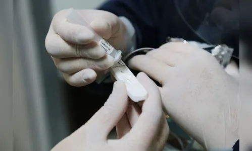 Saúde envia mais 464 mil testes para diagnóstico da Covid-19