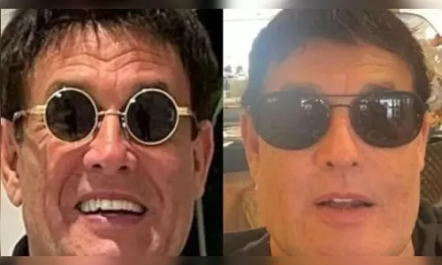 Sergio Mallandro choca fãs ao fazer harmonização facial