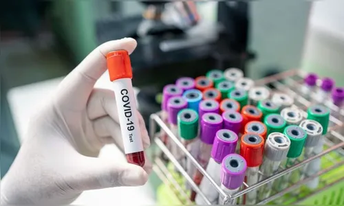 Novo recorde diário de novos casos de Covid em Ivaiporã