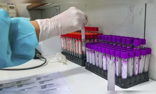 Novo Itacolomi registra mais uma morte por Covid