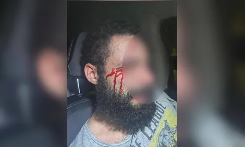 Médica que mandou cortar pênis do ex-noivo é investigada