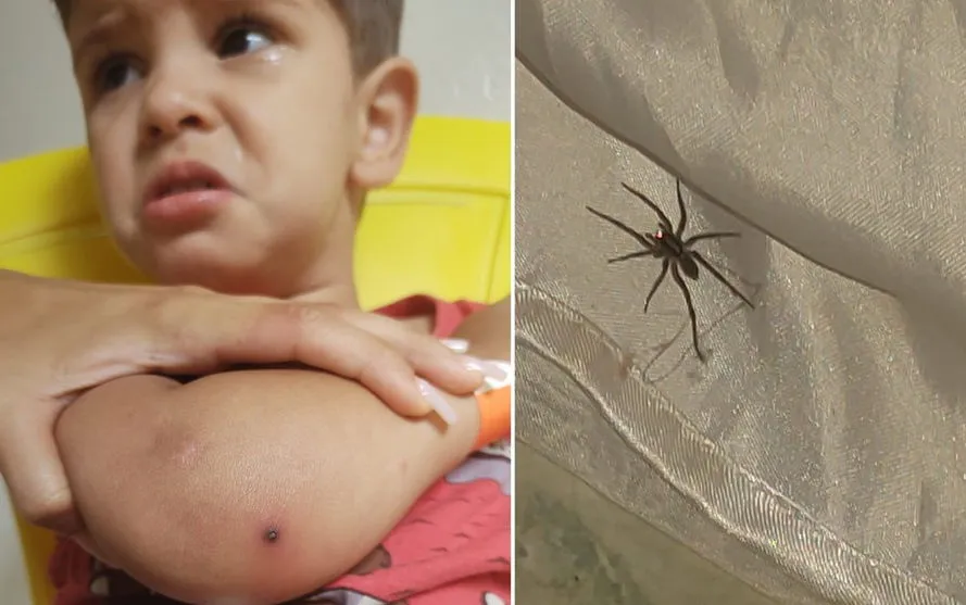 Menino de 2 anos é internado depois de ser picado por aranha