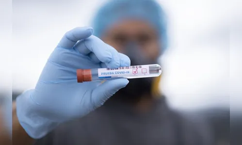 Apucarana registra 110 casos de Covid-19 neste sábado