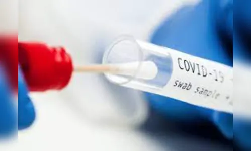 Apucarana registra seis casos de Covid-19 neste domingo