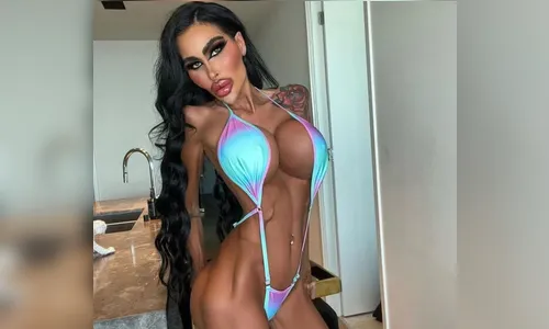 'Barbie humana' já gastou cerca de R$ 1 milhão em cirurgias