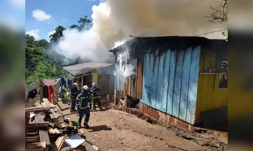 Bebê de 6 meses tem 70% do corpo queimado em incêndio no PR