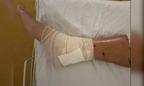 Homem sofre mais de 50 mordidas após ser atacado por pitbulls