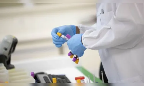 Ivaiporã tem oito casos positivos de Covid-19 neste domingo