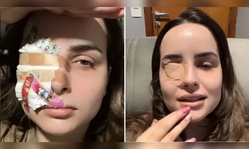 Influenciadora quase fica cega ao coçar olho com unhas