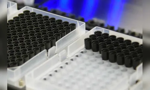 Laboratório da UEM é referência no combate à tuberculose