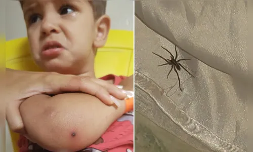 Menino de 2 anos é internado depois de ser picado por aranha
