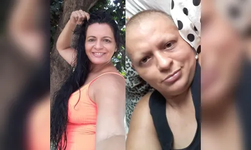 Mulher descobre câncer avançado; médico diz que é gordura
