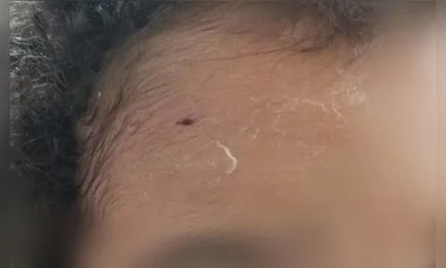 Pitbull ataca mãe e filho no interior de petshop em SP