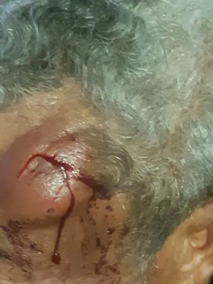 Idoso é agredido durante assalto em Apucarana nesta terça