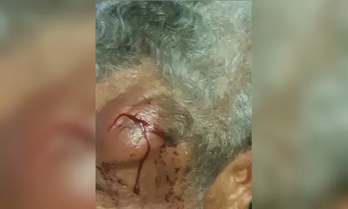 Idoso é agredido durante assalto em Apucarana nesta terça
