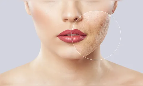 Pele de mulher rejuvenesce 30 anos durante estudo