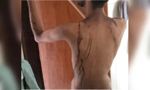 Suspeitos de trote violento pagam fiança de R$ 10 mil e deixam prisão