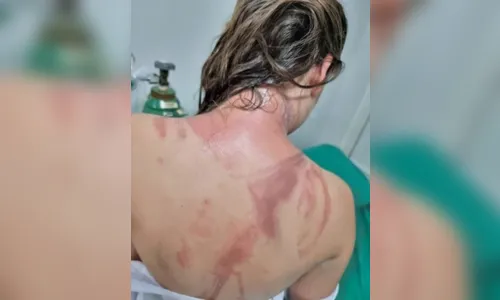 UFPR: suspeitos de aplicar trote violento são afastados