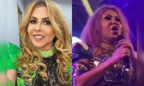 Joelma surge com rosto inchado em show e preocupa fãs
