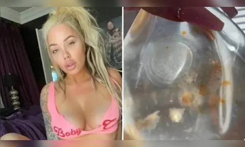 Mulher viraliza ao mostrar próteses 'nojentas' de silicone