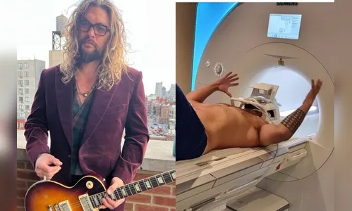 Jason Momoa passa por ressonância após acidente em gravações