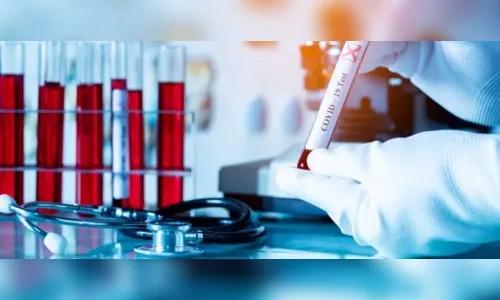 Maringá registra 444 novos casos de covid-19 neste terça