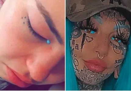 Modelo fala de cegueira e lágrimas azuis ao tatuar os olhos