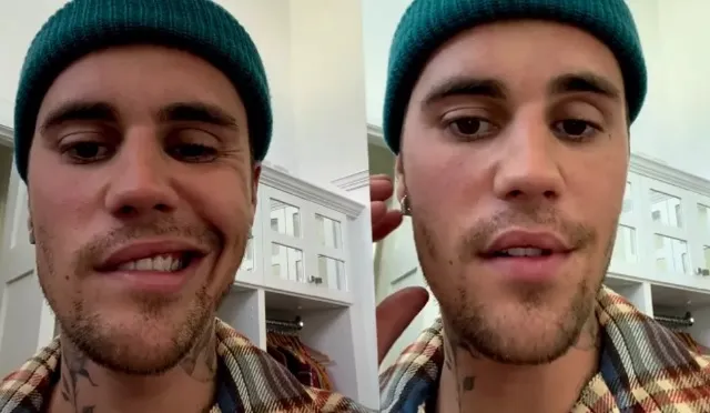 "Não sabemos quanto tempo vai durar, mas vai ficar tudo bem", explicou Justin Bieber