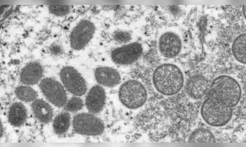 Pacientes com varíola dos macacos estão isolados em São Paulo