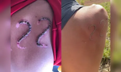 Jovem é 'carimbado' com 22 de Bolsonaro após ser desafiado